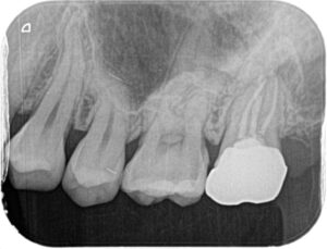 レントゲン画像